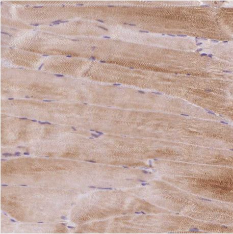 Immunohistochemistry (Formalin/PFA-fixed paraffin-embedded sections) - Anti-PRRC2A antibody (AB188301)