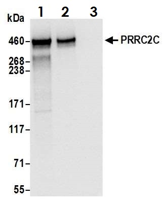 Immunoprecipitation - Anti-PRRC2C antibody (AB117790), expandable thumbnail