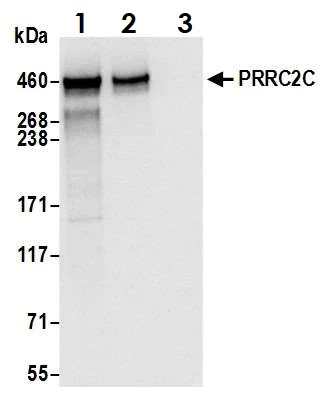 Immunoprecipitation - Anti-PRRC2C antibody (AB117790)