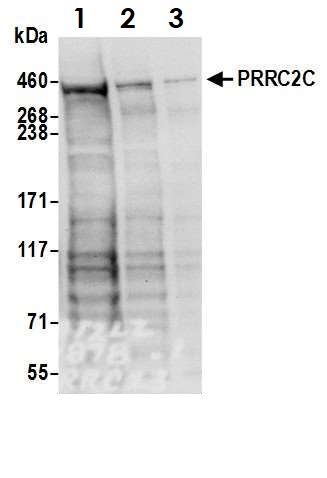 Western blot - Anti-PRRC2C antibody (AB117790), expandable thumbnail