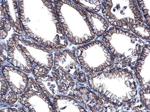Immunohistochemistry (Formalin/PFA-fixed paraffin-embedded sections) - Anti-PRRG2 antibody (AB228870), expandable thumbnail