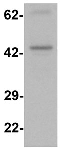 Western blot - Anti-PRRT2 antibody (AB167130), expandable thumbnail
