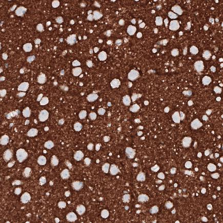 Immunohistochemistry (Formalin/PFA-fixed paraffin-embedded sections) - Anti-PRRT2 antibody [CL4233] (AB219960), expandable thumbnail