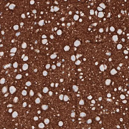 Immunohistochemistry (Formalin/PFA-fixed paraffin-embedded sections) - Anti-PRRT2 antibody [CL4233] (AB219960)