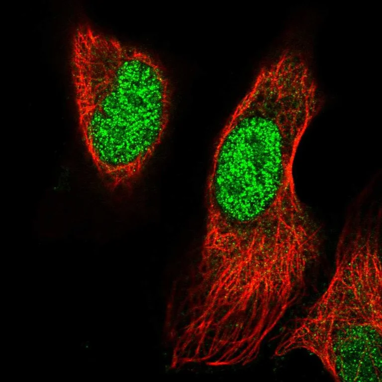 Immunocytochemistry/ Immunofluorescence - Anti-PRRX1 Antibody (AB327258)