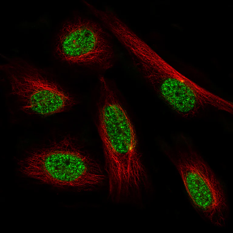 Immunocytochemistry/ Immunofluorescence - Anti-PRRX1 Antibody [CL14471] (AB327154)
