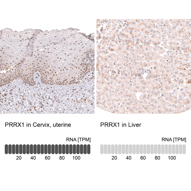 Immunohistochemistry (Formalin/PFA-fixed paraffin-embedded sections) - Anti-PRRX1 Antibody [CL14471] (AB327154)
