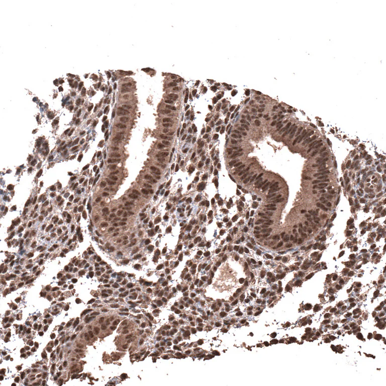 Immunohistochemistry (Formalin/PFA-fixed paraffin-embedded sections) - Anti-PRRX1 Antibody [CL14471] (AB327154)