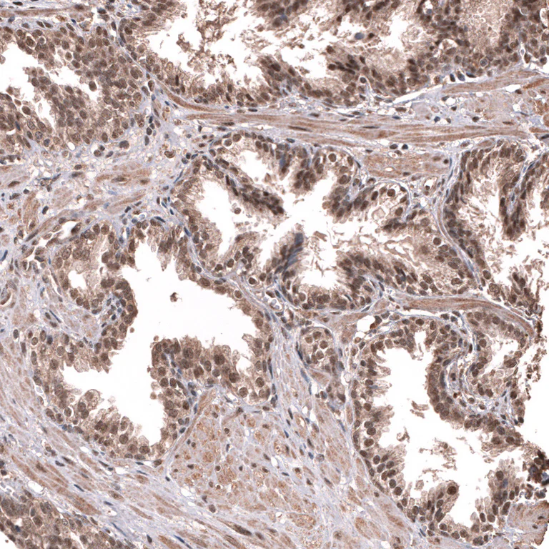Immunohistochemistry (Formalin/PFA-fixed paraffin-embedded sections) - Anti-PRRX1 Antibody [CL14471] (AB327154)
