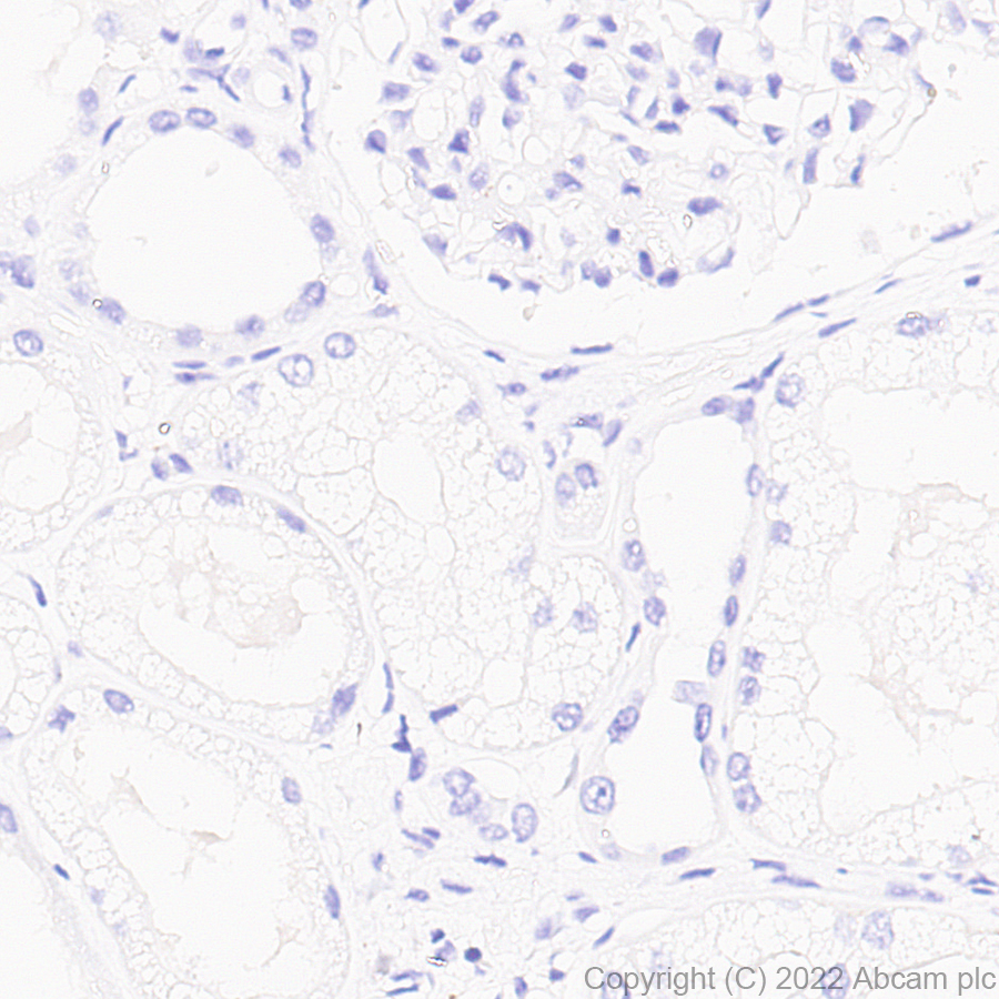 Immunohistochemistry (Formalin/PFA-fixed paraffin-embedded sections) - Anti-PRSS2 antibody [EPR25648-5] (AB302603), expandable thumbnail