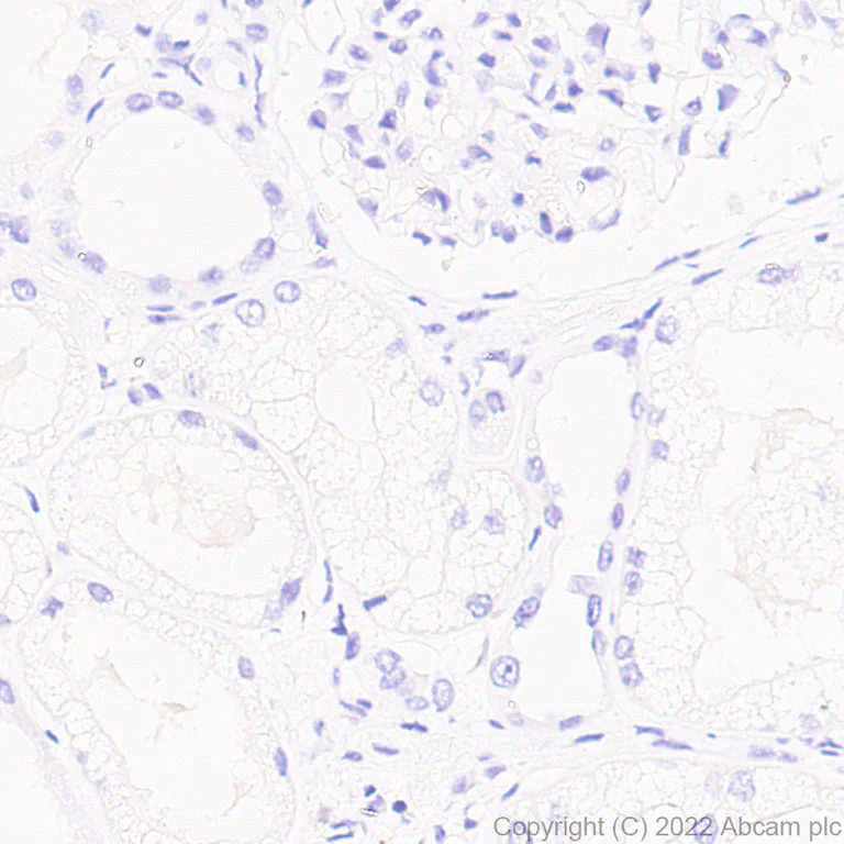 Immunohistochemistry (Formalin/PFA-fixed paraffin-embedded sections) - Anti-PRSS2 antibody [EPR25648-5] (AB302603)