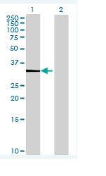 Western blot - Anti-PRSS21/ESP1 antibody (AB68534)
