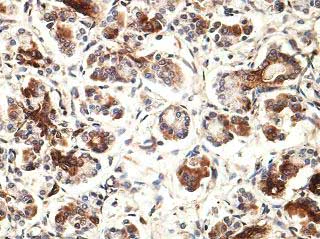 Immunohistochemistry (Formalin/PFA-fixed paraffin-embedded sections) - Anti-PRSS22 antibody (AB197158)