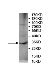 Western blot - Anti-PRSS22 antibody (AB197158)