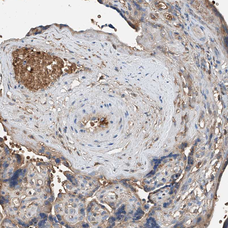Immunohistochemistry (Formalin/PFA-fixed paraffin-embedded sections) - Anti-PRSS23 antibody (AB122115)