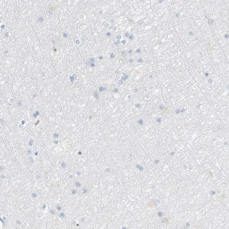 Immunohistochemistry (Formalin/PFA-fixed paraffin-embedded sections) - Anti-PRSS23 antibody (AB122115)
