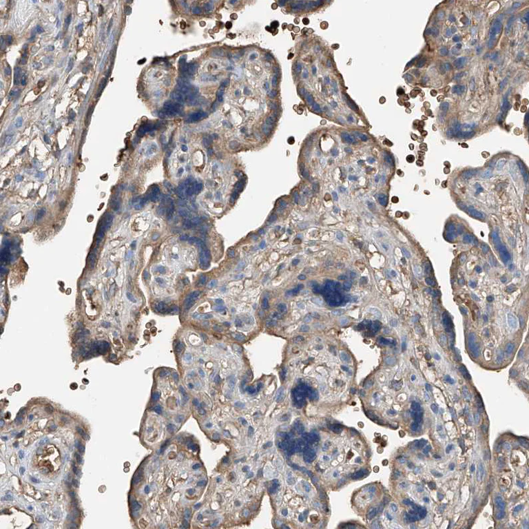 Immunohistochemistry (Formalin/PFA-fixed paraffin-embedded sections) - Anti-PRSS23 antibody (AB122115)