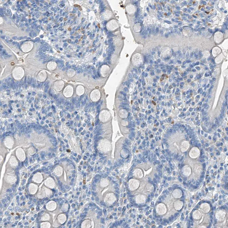 Immunohistochemistry (Formalin/PFA-fixed paraffin-embedded sections) - Anti-PRSS23 antibody (AB122115)