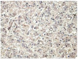 Immunohistochemistry (Formalin/PFA-fixed paraffin-embedded sections) - Anti-PRSS23 antibody (AB201182)