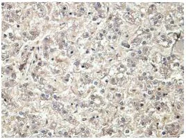 Immunohistochemistry (Formalin/PFA-fixed paraffin-embedded sections) - Anti-PRSS23 antibody (AB201182)