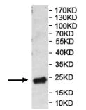 Western blot - Anti-PRSS23 antibody (AB201182)