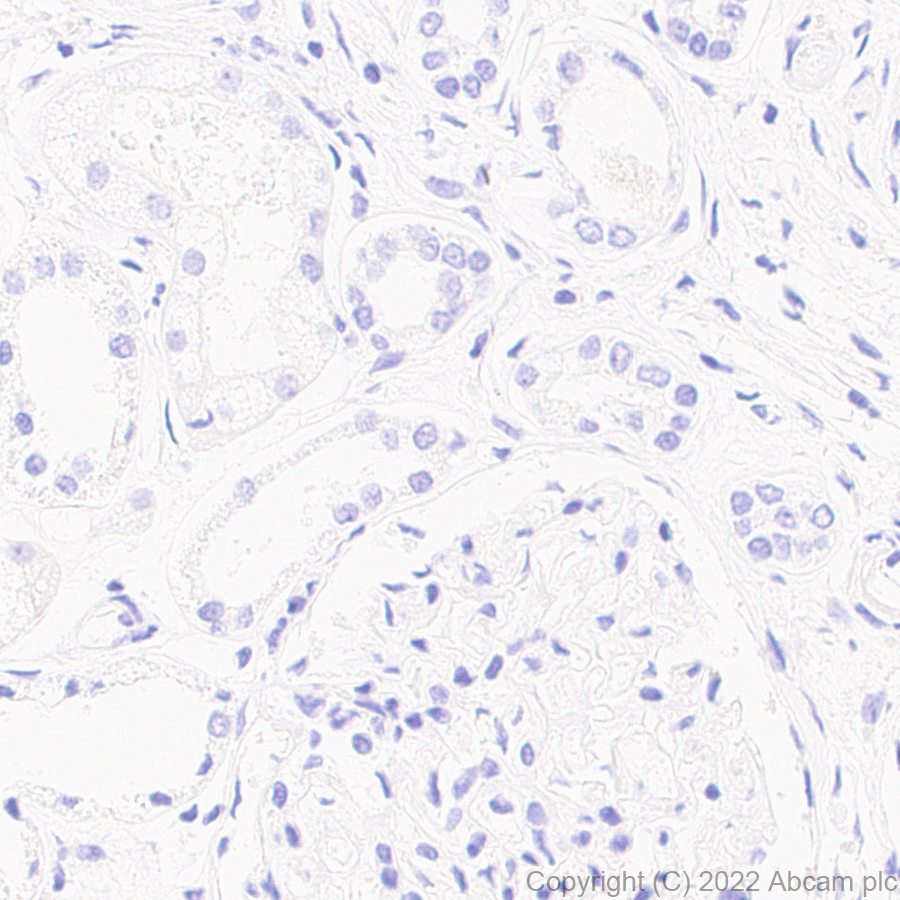 Immunohistochemistry (Formalin/PFA-fixed paraffin-embedded sections) - Anti-PRSS2+PRSS3 antibody [EPR25648-13] (AB302605), expandable thumbnail