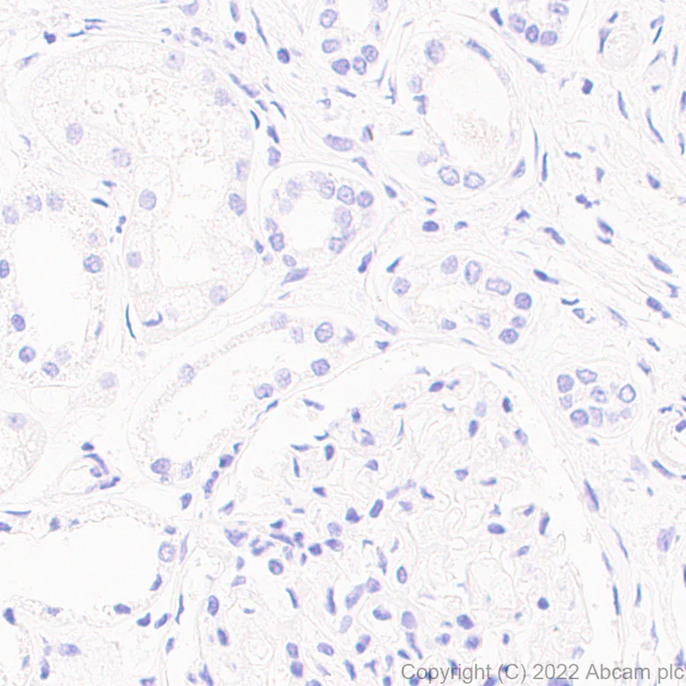 Immunohistochemistry (Formalin/PFA-fixed paraffin-embedded sections) - Anti-PRSS2+PRSS3 antibody [EPR25648-13] (BSA and Azide free) (AB302606)