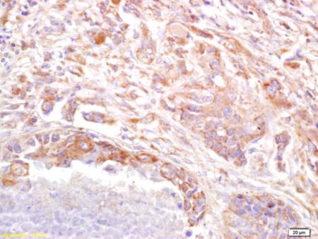 Immunohistochemistry (Formalin/PFA-fixed paraffin-embedded sections) - Anti-PRSS8 antibody (AB203879)