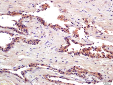 Immunohistochemistry (Formalin/PFA-fixed paraffin-embedded sections) - Anti-PRSS8 antibody (AB203879)