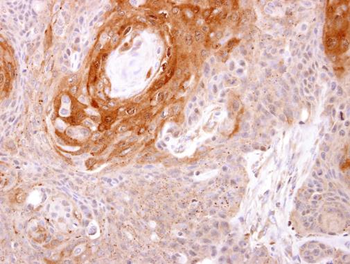 Immunohistochemistry (Formalin/PFA-fixed paraffin-embedded sections) - Anti-PRSS8 antibody (AB227225), expandable thumbnail