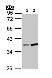 Western blot - Anti-PRSS8 antibody (AB227225)