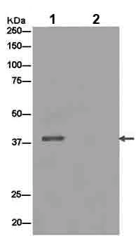 Immunoprecipitation - Anti-PRSS8 antibody [EPR15327] (AB185236)