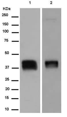 Western blot - Anti-PRSS8 antibody [EPR15327] (AB185236)