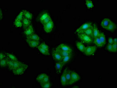 Immunocytochemistry/ Immunofluorescence - Anti-PRUNE antibody (AB237518)