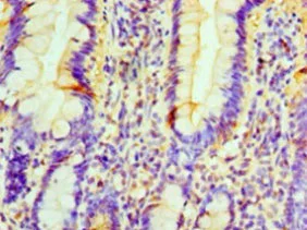 Immunohistochemistry (Formalin/PFA-fixed paraffin-embedded sections) - Anti-PRUNE antibody (AB237518)