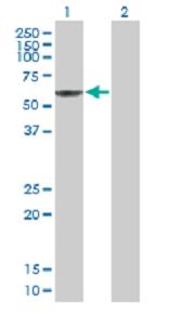 Western blot - Anti-PRUNE antibody (AB88613), expandable thumbnail