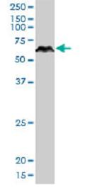 Western blot - Anti-PRUNE antibody (AB88613), expandable thumbnail