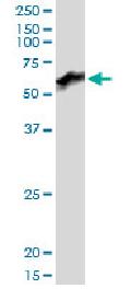 Western blot - Anti-PRUNE antibody (AB88613), expandable thumbnail