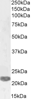 Western blot - Anti-PRX-1 antibody (AB106834), expandable thumbnail