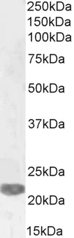 Western blot - Anti-PRX-1 antibody (AB106834)