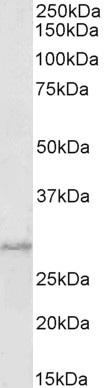 Western blot - Anti-PRX-1 antibody (AB106834), expandable thumbnail