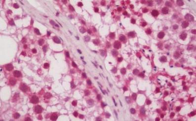 Immunohistochemistry (Formalin/PFA-fixed paraffin-embedded sections) - Anti-PRX-1 antibody (AB211292)