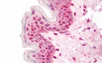 Immunohistochemistry (Formalin/PFA-fixed paraffin-embedded sections) - Anti-PRX-1 antibody (AB211292)
