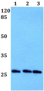 Western blot - Anti-PRX-2 antibody (AB191535)