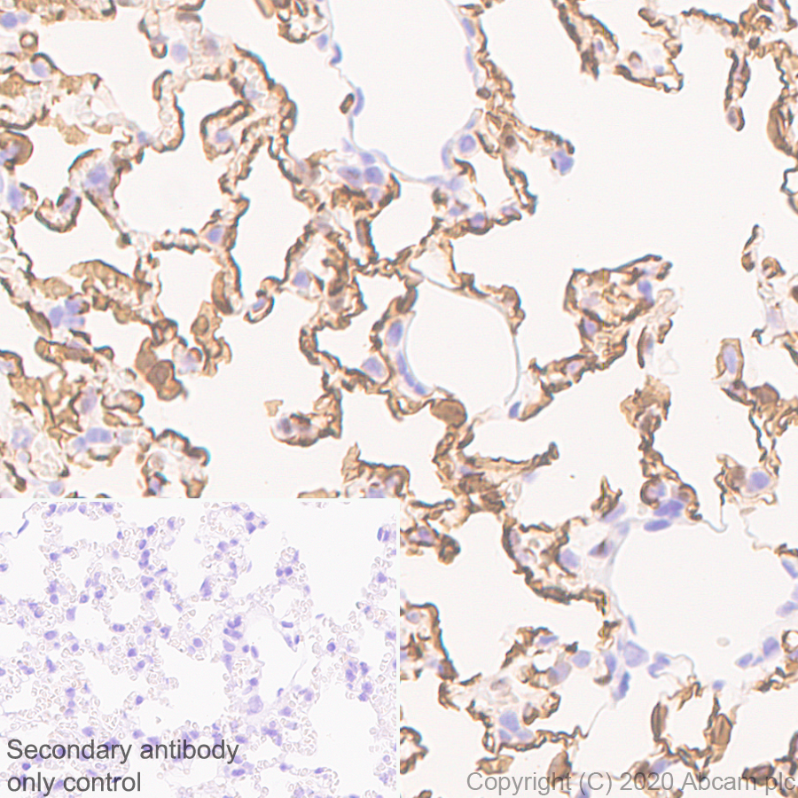 Immunohistochemistry (Formalin/PFA-fixed paraffin-embedded sections) - Anti-PRX antibody [EPR24150-36] (AB259953), expandable thumbnail