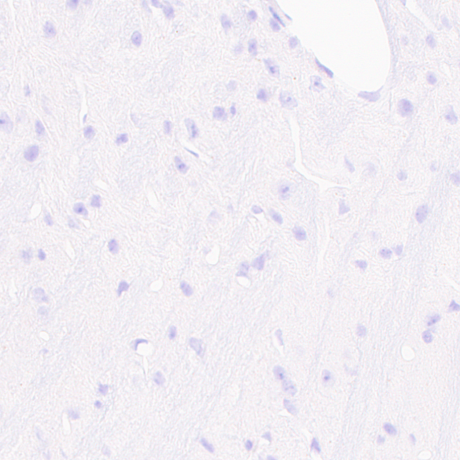 Immunohistochemistry (Formalin/PFA-fixed paraffin-embedded sections) - Anti-PRX antibody [EPR24150-36] (ab259953), expandable thumbnail