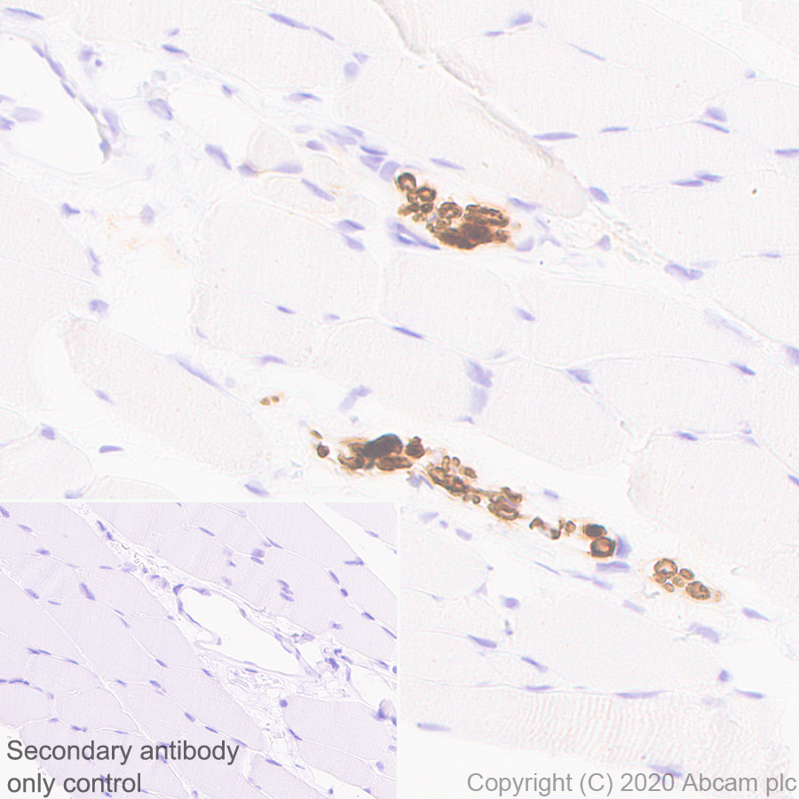 Immunohistochemistry (Formalin/PFA-fixed paraffin-embedded sections) - Anti-PRX antibody [EPR24150-36] (ab259953), expandable thumbnail