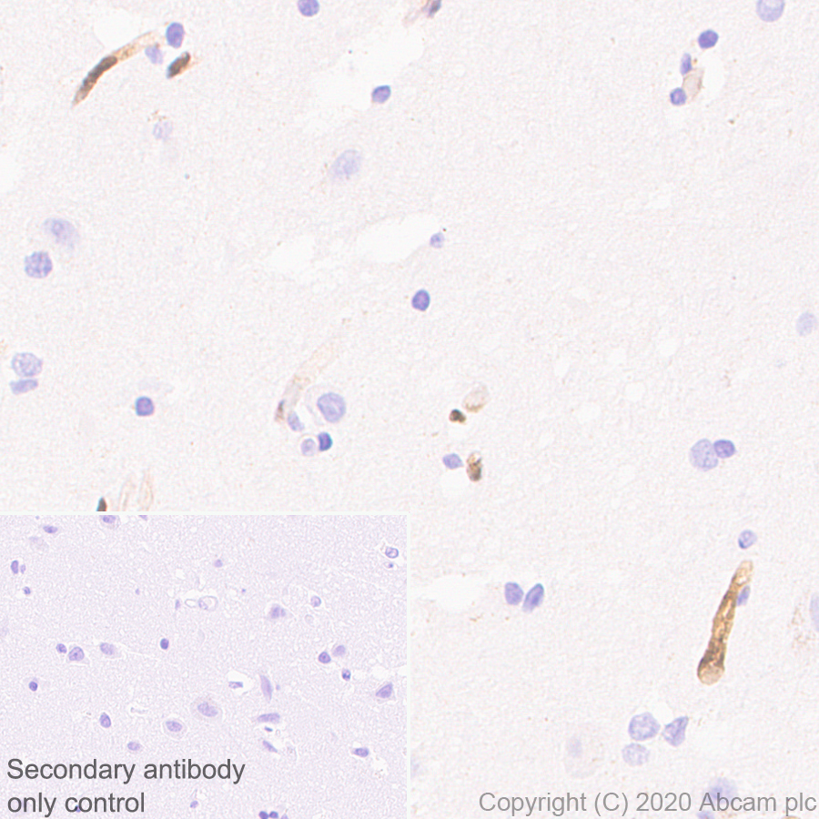 Immunohistochemistry (Formalin/PFA-fixed paraffin-embedded sections) - Anti-PRX antibody [EPR24150-36] (AB259953), expandable thumbnail