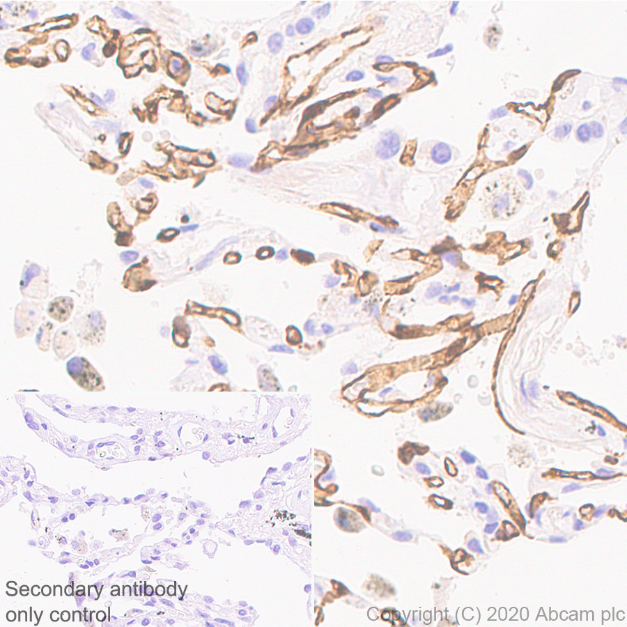 Immunohistochemistry (Formalin/PFA-fixed paraffin-embedded sections) - Anti-PRX antibody [EPR24150-36] (AB259953), expandable thumbnail