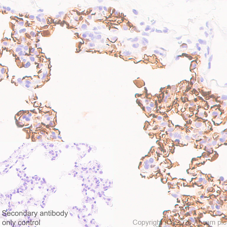 Immunohistochemistry (Formalin/PFA-fixed paraffin-embedded sections) - Anti-PRX antibody [EPR24150-36] - BSA and Azide free (AB278083)